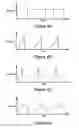 Fig. 08 - Electrically enhanced retrieval of material from vessel lumens