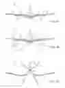 Fig. 02 - Methods and devices for tissue grasping and assessment