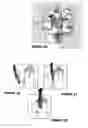 Fig. 08 - Method for ultrasonic tissue excision with tissue selectivity