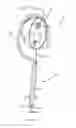 Fig. 07 - Thrombectomy catheter and methods of use