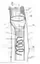 Fig. 01 - THROMBECTOMY CATHETER AND A DEVICE COMPRISING THE SAME