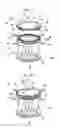 Fig. 02 - Medical retractor device