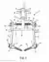 Fig. 02 - Spinal stabilization system with adjustable interlaminar devices
