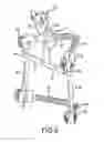 Fig. 06 - Spinal stabilization system with adjustable interlaminar devices