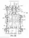 Fig. 35 - Spinal stabilization system with adjustable interlaminar devices