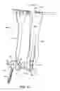 Fig. 45 - Spinal stabilization system with adjustable interlaminar devices
