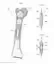 Fig. 06 - DEVICE AND METHOD FOR BONE ADJUSTMENT OPERATING WITH WIRELESS TRANSMISSION ENERGY