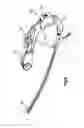 Fig. 07 - Intramedullary nail with cannulation access hole