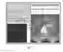 Fig. 08 - SYSTEM AND METHOD FOR ABLATING A TISSUE SITE BY ELECTROPORATION WITH REAL-TIME MONITORING OF TREATMENT PROGRESS