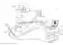 Fig. 01 - BALLOON CATHETER DISTAL END COMPRISING ELECTRODES AND THERMOCOUPLES