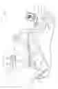 Fig. 02 - BALLOON CATHETER DISTAL END COMPRISING ELECTRODES AND THERMOCOUPLES