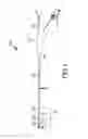 Fig. 02 - Magnetic guided ablation catheter