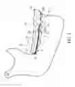 Fig. 02 - Orthodontic correction device