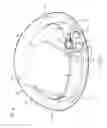 Fig. 09 - Adjustable implant