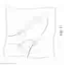 Fig. 12 - Apparatus, system and methods for improved breast surgery with myointegration