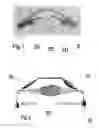 Fig. 02 - Systems, devices, and/or methods for managing implantable devices