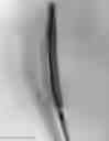Fig. 02 - METHOD AND APPARATUS FOR PRACTICE OF TAVR EMPLOYING AN EXPANDABLE MESH-LIKE CATHETER