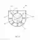 Fig. 22 - Adjustable prosthetic heart valve