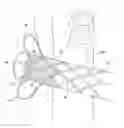 Fig. 01 - Vena-caval device