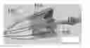 Fig. 01 - Actively controllable heart valve implant and method of controlling same