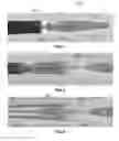 Fig. 02 - Actively controllable heart valve implant and method of controlling same