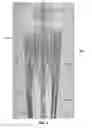 Fig. 03 - Actively controllable heart valve implant and method of controlling same