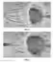 Fig. 04 - Actively controllable heart valve implant and method of controlling same