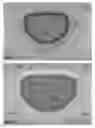 Fig. 06 - Actively controllable heart valve implant and method of controlling same
