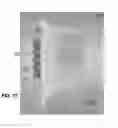 Fig. 08 - Actively controllable heart valve implant and method of controlling same