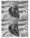 Fig. 11 - Actively controllable heart valve implant and method of controlling same