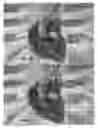 Fig. 12 - Actively controllable heart valve implant and method of controlling same