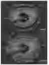 Fig. 18 - Actively controllable heart valve implant and method of controlling same