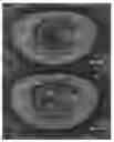 Fig. 20 - Actively controllable heart valve implant and method of controlling same