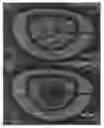 Fig. 23 - Actively controllable heart valve implant and method of controlling same