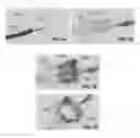 Fig. 24 - Actively controllable heart valve implant and method of controlling same