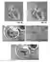Fig. 25 - Actively controllable heart valve implant and method of controlling same