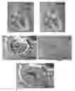 Fig. 27 - Actively controllable heart valve implant and method of controlling same
