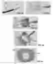 Fig. 28 - Actively controllable heart valve implant and method of controlling same