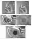 Fig. 29 - Actively controllable heart valve implant and method of controlling same
