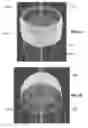 Fig. 35 - Actively controllable heart valve implant and method of controlling same
