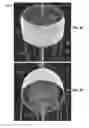Fig. 36 - Actively controllable heart valve implant and method of controlling same