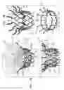 Fig. 02 - Prosthetic valve with concentric frames