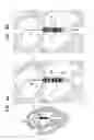 Fig. 08 - Prosthetic valve with concentric frames
