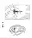 Fig. 11 - Prosthetic valve with concentric frames