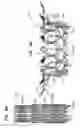 Fig. 14 - Prosthetic valve with concentric frames