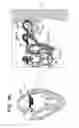 Fig. 16 - Prosthetic valve with concentric frames