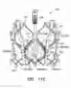 Fig. 20 - Prosthetic valve with concentric frames