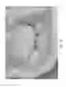 Fig. 05 - Device, system, and method for transcatheter treatment of valvular regurgitation