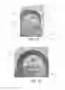 Fig. 18 - Device, system, and method for transcatheter treatment of valvular regurgitation