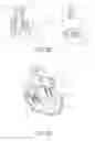 Fig. 26 - Device, system, and method for transcatheter treatment of valvular regurgitation
